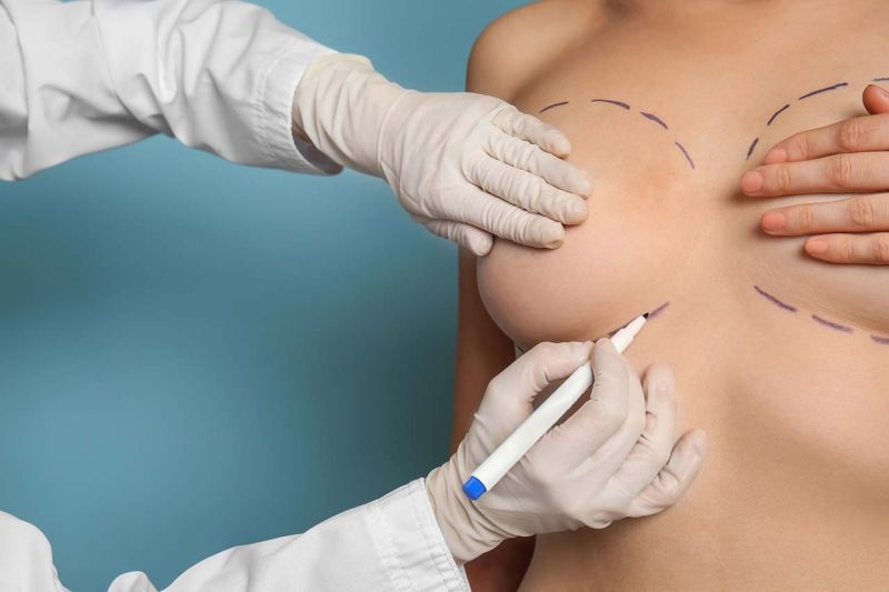 breast implant revision surgery in tucson arizona